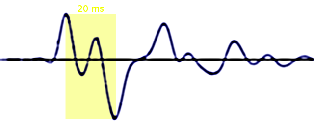 Use biiggest peak as trigger, then time-shift -20ms (if you must).png